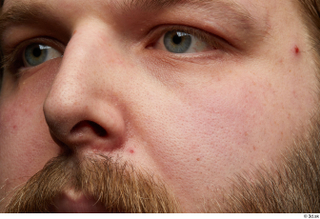 HD Face Skin Robert Watson cheek face nose skin pores…